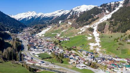 Im österreichischen Ort St. Anton am Arlberg hat ein Unbekannter einem Touristen die Nasenspitze abgebissen. 