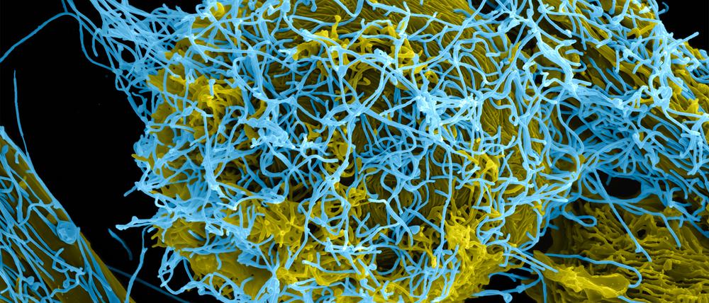 Ebola-Viren (blau koloriert) werden fast nie über Samen oder Speichel verbreitet, weil darin Massen winziger Fettbläschen enthalten sind, die den Erregern den Weg in die Zellen erschweren.