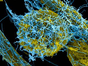 Ebola-Viren (blau koloriert) werden fast nie über Samen oder Speichel verbreitet, weil darin Massen winziger Fettbläschen enthalten sind, die den Erregern den Weg in die Zellen erschweren.