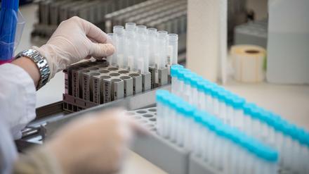 Eine Labormitarbeiterin bereitet in einem hessischen Labor Teströhrchen für einen PCR-Test vor.