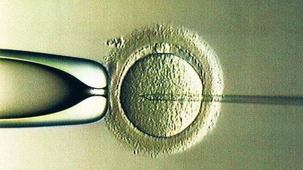 Austauschmanöver. Britische Forscher haben die Zellkerne eines menschlichen Embryos in eine andere Eizelle überführt. Die Mitochondrien des neuen Embryos stammen von der Spendermutter. So könnten Erbkrankheiten der Mitochondrien verhindert werden. Foto: dpa
