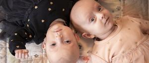 Einst am Bauch verbundene Zwillinge liegen nach der erfolgreichen Trennung Kopf an Kopf nebeneinander. Sieben Wochen nach der Geburt haben Mediziner des Universitätsklinikums Hamburg-Eppendorf (UKE) am Bauch miteinander verbundene Zwillinge erfolgreich getrennt.