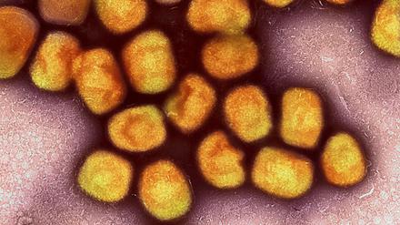 Eine kolorierte transmissionselektronenmikroskopische Aufnahme von Partikeln des Affenpockenvirus (Gold), kultiviert und gereinigt aus einer Zellkultur, aufgenommen in der NIAID Integrated Research Facility