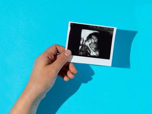 Ein Ultraschallbild symbolisiert den Babywunsch.