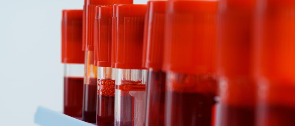 Mithilfe von Blutanalysen sollen Nährstoffmängel frühzeitig ausfindig gemacht werden.