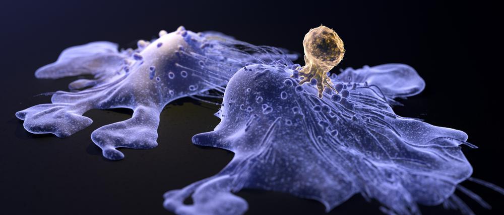 Krebszelle (blau) wird von Immunzelle (braun) angegriffen – mRNA-Impfstoffe könnten die Attacke künftig noch wirkungsvoller machen.