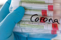 Die positiven Corona-Tests der Infizierten stammen aus der vergangenen Woche. (Symbolbild)