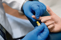 Im Labor wird einer Person Blut für einen HIV-Test entnommen (Symbolbild).