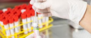 Ein Biologielaborant bereitet eine Probe von einem Rachenabstrich für einer Infektion mittels PCR vor. 