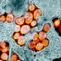 Eine Mikrografie von SARS-CoV-2 Partikeln, auch bekannt als Coronavirus.