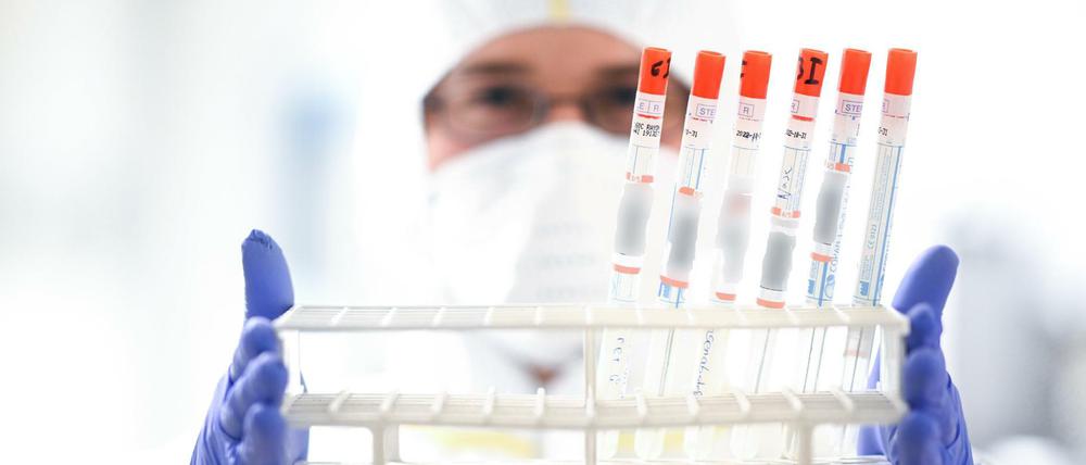 Ein Labor-Mitarbeiter hält einen Ständer mit diversen Rachenabstrichröhrchen in den Händen.