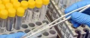 Vulnerable Gruppen sollen bei PCR-Tests künftig bevorzugt behandelt werden.