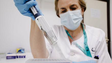 Eine Krankenschwester bereitet einen PCR-Tests zur Erkennung des Affenpockenvirus vor. 