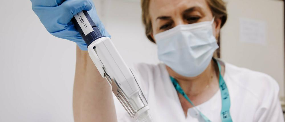 Eine Krankenschwester bereitet einen PCR-Tests zur Erkennung des Affenpockenvirus vor. 