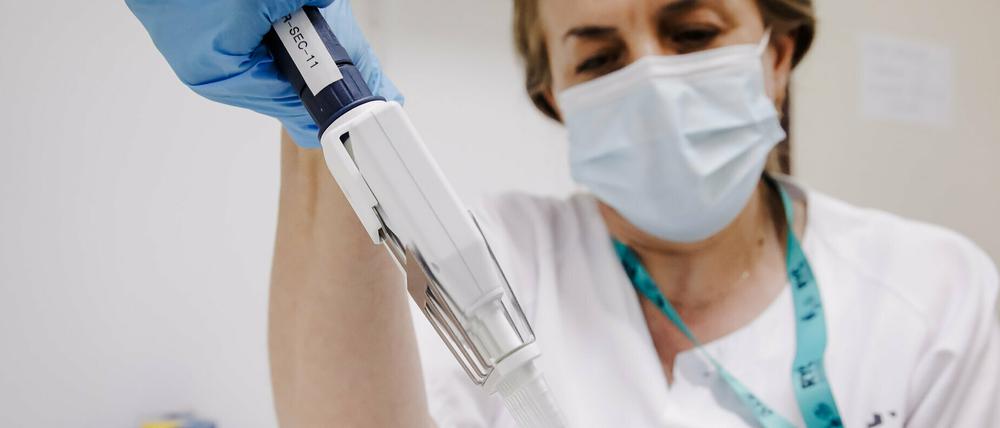 Eine Krankenschwester bereitet einen PCR-Tests zur Erkennung des Affenpockenvirus vor.