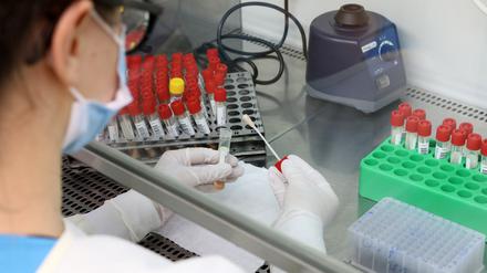 Ein Teil der Proben von PCR-Corona-Tests wird auf Mutationen untersucht. 