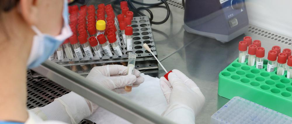 Ein Teil der Proben von PCR-Corona-Tests wird auf Mutationen untersucht. 