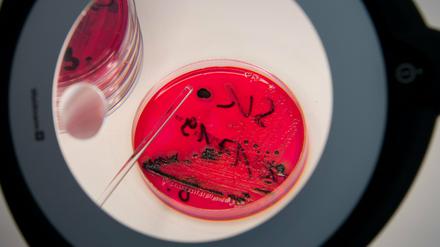 Salmonellen in einer Petrischale: Die Bakterien können zu Durchfall, Übelkeit oder auch Erbrechen führen