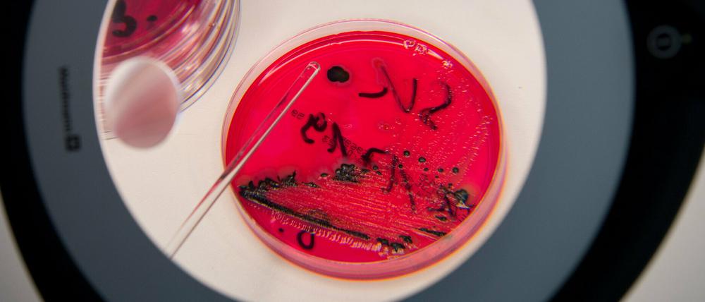 Salmonellen in einer Petrischale: Die Bakterien können zu Durchfall, Übelkeit oder auch Erbrechen führen