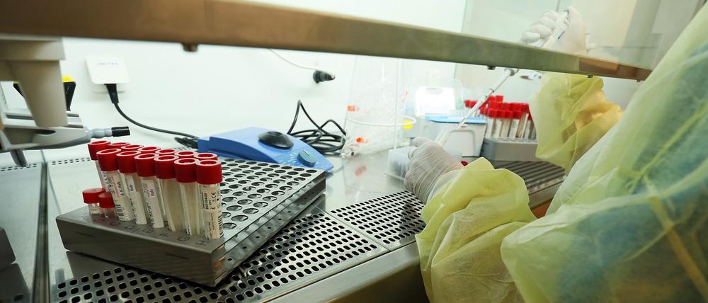 Der Bergmann-Klinikum testet Proben bislang nur mit PCR auf der Coronavirus und mit Target-PCR auf Virusvarianten. Bald sollen auch Sequenzierungen möglich sein.