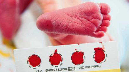 Mit nur einem Tropfen Blut könnten Neugeborene auf die seltene Kinderdemenz NCL getestet werden.