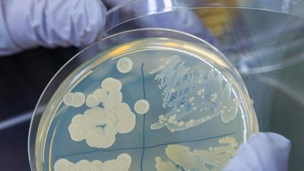 Eine Laborprobe mit E. coli-Bakterien.