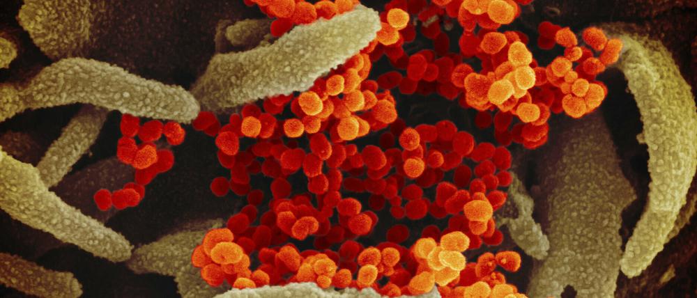 Eine undatierte elektronenmikroskopische Aufnahme des «U.S. National Institute of Health» zeigt das Coronavirus (SARS-CoV-2) (orange).