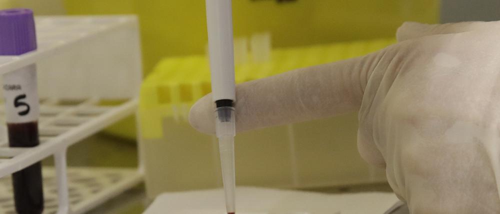 Ein Forscher testet in einem privaten Labor das Blut eines Patienten auf das  Coronavirus. 
