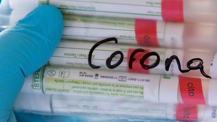 In den letzten 24 Stunden gab es keine Coronavirus-Neuinfektion, meldete der Landkreis am 19. Mai 2020.