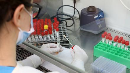 Vorbereitung eines PCR-Tests zur Analyse. (Symbolbild)
