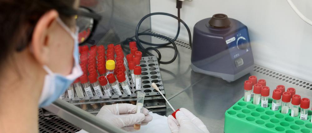 Vorbereitung eines PCR-Tests zur Analyse. (Symbolbild)