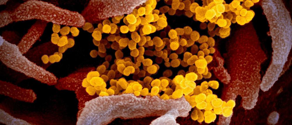 Elektronenmikroskopische Aufnahme von Sars-Cov-2-Körperchen (gelb), die sich von einer infizierten Zelle abschnüren. (angefärbt)