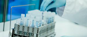 Ein Mitarbeiter hält in einem Coronatest-Labor PCR-Teströhrchen in den Händen.