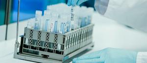 Ein Mitarbeiter hält in einem Coronatest-Labor PCR-Teströhrchen in den Händen. 