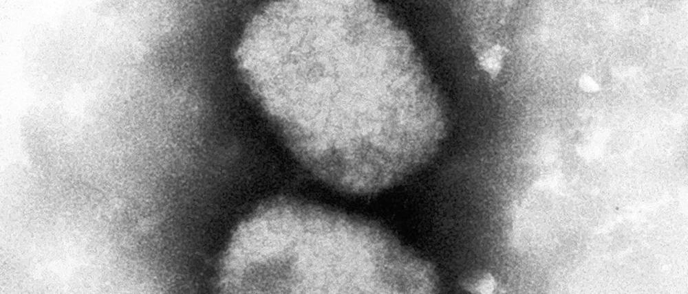 Über das Affenpocken-Virus weiß die Forschung noch wenig.